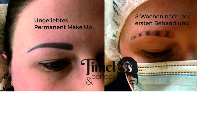 Permanent Make Up entfernen, timeless&perfect.de